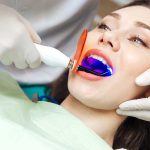 کامپوزیت دندان ها و مراقبت های ضروری پس از آن