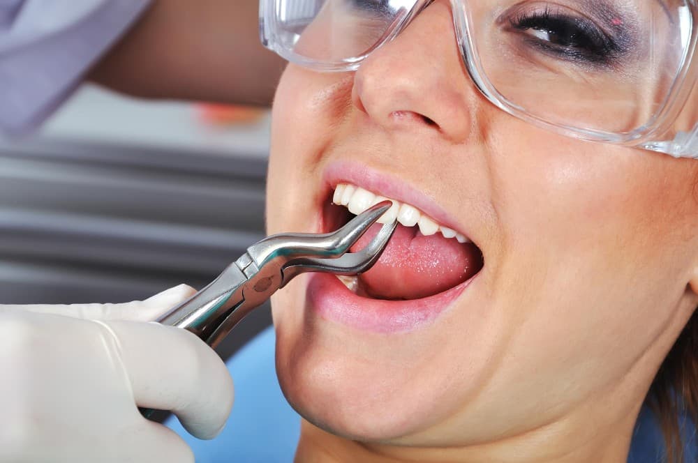 کدام دندان ها در ارتودنسی کشیده می شود