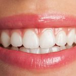 تقویت مینای دندان و راه های جلوگیری از فرسایش آن
