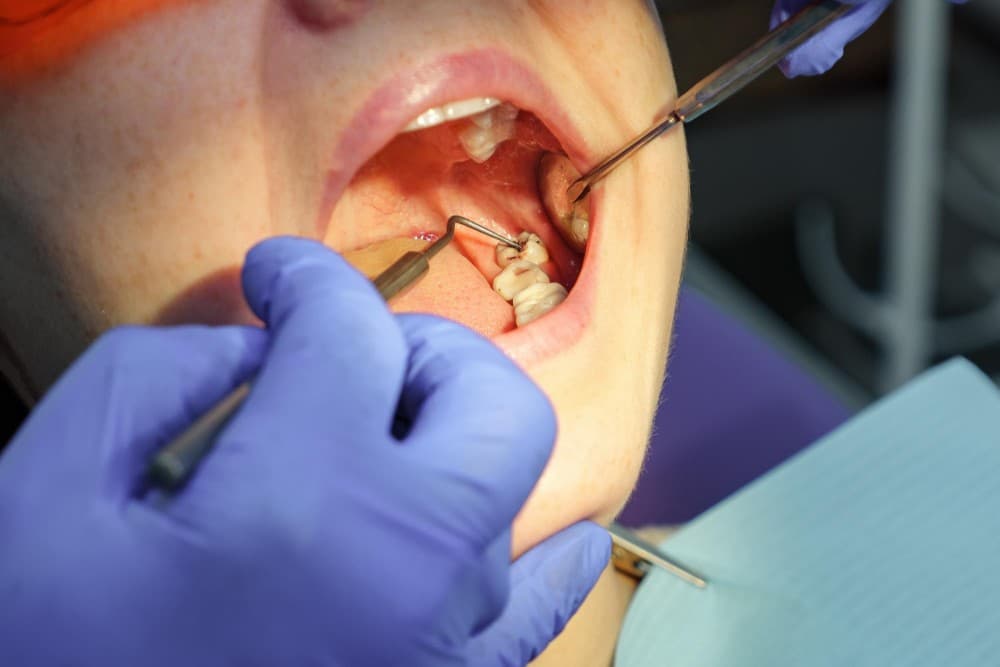 بهترین روش ترمیم دندان