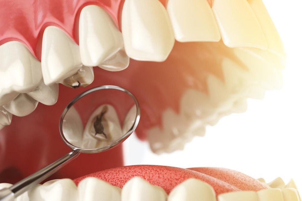 روش های ترمیم دندان