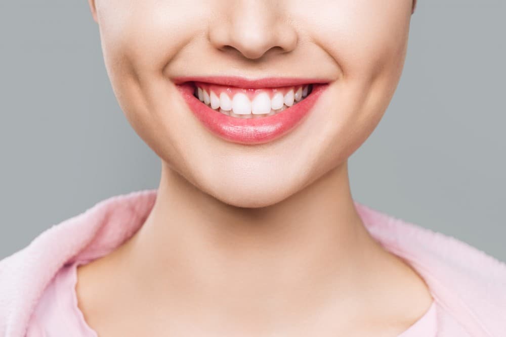 جرم گیری دندان بهتر است یا بلیچینگ؟