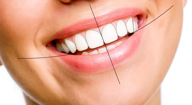 معرفی انواع خدمات دندانپزشکی زیبایی